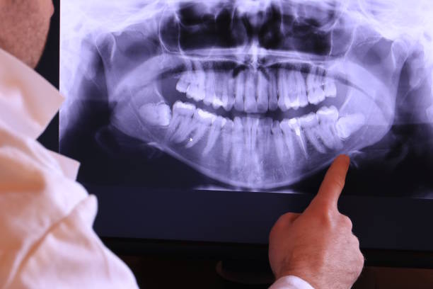 Best Dental Abscess Treatment in Brookwood, AL